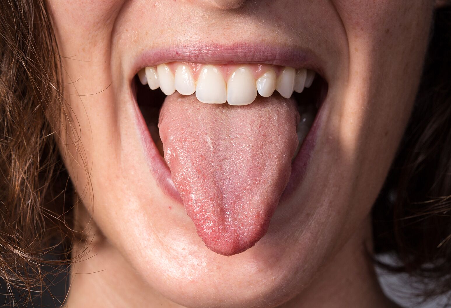 Sore Tongue After Drinking Alcohol