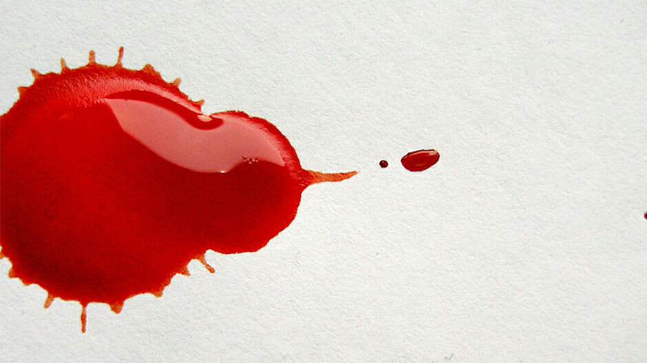 Bleeding After Drinking Alcohol
